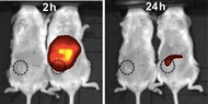 After two hours, special nanoparticles accumulated in cancer cells (red and yellow) in mice and destroyed most of the tumor within a day (right).
Credit: American Chemical Society 