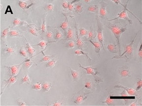 The cells in this image have turned fluorescent pink, showing that the new drug delivery system results in high cellular uptake after being irradiated by near infrared light.
CREDIT: Jennifer West, Duke University