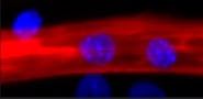 Scientists coaxed the development of this muscle cell from an adult stem cell. 
Credit: American Chemical Society 