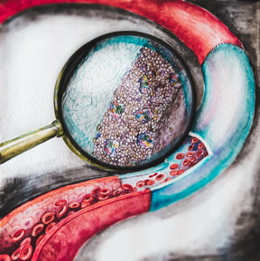 This is an artist's representation of the improved vascular graft. The enlarged section shows the drug-entrapping coating attached to the inner surface of the graft.
CREDIT: ITMO University/Yulia Chapurina