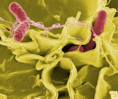 Salmonella bacteria under a microscope. Photo by NIAID / Wikipedia.