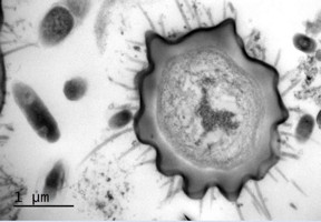 This electron-microscope image expose the spines, or "nanopillars," that poke up from the body of the rat-tailed maggot. The length and density of the spines vary as shown in this cross-section image of the cuticle.
CREDIT: Matthew Hayes