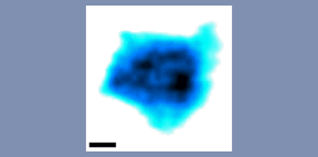 Video imaging by high-speed AFM captures native nuclear pore complexes at work; the inset scale bar is 10 nanometers. Image: University of Basel