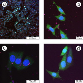 These are confocal fluorescence microscopy images of CF2Th cancer cells incubated with LA-Si NPs.
CREDIT: Victor Timoshenko/Scientific Reports