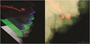This is a scanning transmission electron microscope image of a nickel-platinum composite material created at The Ohio State University. At left, the image is overlaid with false-color maps of elements in the material, including platinum (red), nickel (green) and oxygen (blue).
CREDIT
Imaging by Isabel Boona, OSU Center for Electron Microscopy and Analysis; Left image prepared by Renee Ripley. Courtesy of The Ohio State University.