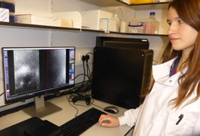 Florence Wagner of Micron Oxford working with the ONI Nanoimager to study structural maintenance of chromosomes (SMC) complexes at the single molecule level