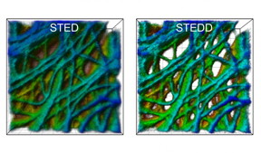 A cancer cell under the microscope: The STED image (left) has a background of low resolution. In the STEDD image (right), background suppression results in much better visible structures.
CREDIT
Image: APH/KIT