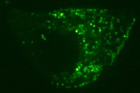 Scientists studied the motion of insulin-containing vesicles, which contain thousands of insulin molecules within an insulin-secreting cell (seen here). This work stimulated collaborative research that led to the development of the single-pixel interior filling function.
CREDIT
Courtesy of Prof. Norbert Scherer