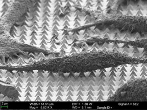 This is a scanning-electron microscope image of chemically-fixed HeLa cancer cells on the substrate. The tips of the pyramids create tiny holes in the cell membranes, allowing molecular cargo to diffuse into the cells.
CREDIT
(Image courtesy of Harvard SEAS)