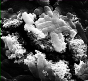 Clusters of nanoparticles with phage viruses attached find and kill Escherichia coli bacteria in a lab test at Rice University. Researchers at Rice and the University of Science and Technology of China have developed a combination of antibacterial phages and magnetic nanoparticle clusters that infect and destroy bacteria that are usually protected by biofilms in water treatment systems. (Credit: Alvarez Group/Rice University)