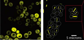 Yeast cells producing a bacterial symmetric protein complex with eight units. When it is not mutated (left), the complex diffuses freely inside the cell, but a single mutation (right) triggers its assembly into long filaments.
CREDIT
Weizmann Institute of Science