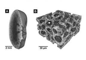 These images were created using the new staining method: left: Micro-CT image of a mouse kidney, right: Nano-CT image of the same tissue.
CREDIT
Mueller, Pfeiffer / TUM / reproduced with permission from PNAS.