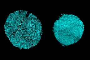 X-ray tomography images taken at Brookhaven National Lab show cracking of a particle in one electrode of a battery cell that used a conventional electrolyte (as seen on the left). The researchers found that using a novel electrolyte prevented most of this cracking (right).
Credits:Image: courtesy of the researchers