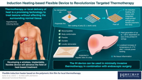 Figure 1 Induction Heating-based Flexible Device to Revolutionize Targeted Thermotherapy.

CREDIT
Tokyo Tech

