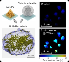 Figure shows 3D reconstruction of the golden vaterite and the laser-induced heating of the spherulites.

CREDIT
Tel Aviv University