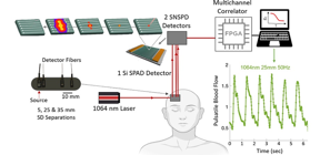 In a new study, researchers from Massachusetts General Hospital developed a superconducting nanowire single photon detector (SNSPD)-based diffuse correlation spectroscopy (DCS) device with a high signal-to-noise ratio and high sensitivity for blood flow. This study marks one of the first-ever applications of SNSPDs in a biomedical setting. The figure shows the setup for blood flow measurement using SNSPD- and SPAD-based DCS devices.

CREDIT
Ozana et al., doi 10.1117/1.NPh.8.3.035006.