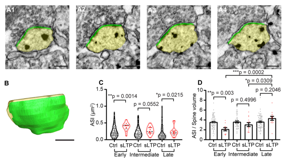 A, B, Serial images of an example spine (A) and 3D reconstruction of the example spine (B) with spine head shown in yellow and ASI shown in green. Scale bar, 200 nm. C, ASI area size at early, intermediate, and late phases of sLTP for sLTP and control (Ctrl) spines. Welch�s t test was used on log-transformed data. D, Ratio of ASI area to spine volume at early, intermediate, and late phases of sLTP.

CREDIT
Max Planck Florida Institute for Neuroscience