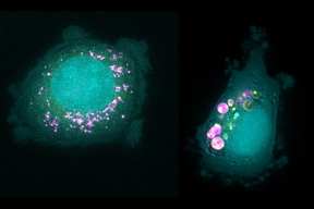 MIT researchers have identified biomarkers that predict whether different types of cancer cells will take up specific nanoparticles. In this image, cells with low levels of a protein called SLC46A3 (left) take up particles called liposomes (pink), while cells with high levels of SLC46A3 (right) do not.
Credits: Image: Courtesy of the researchers